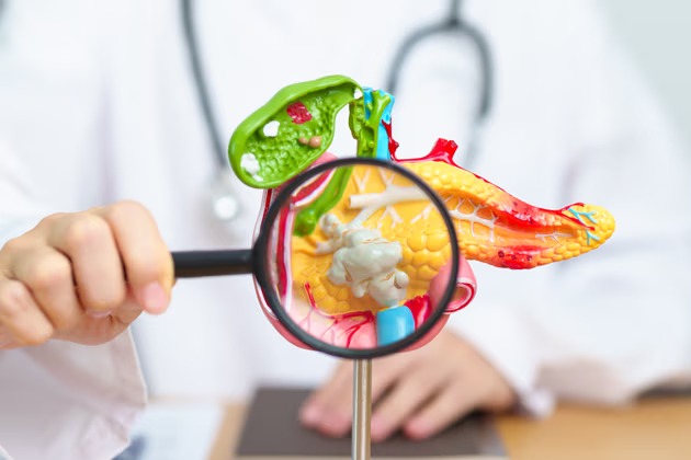 Pankreatit nədir və niyə yaranır? 