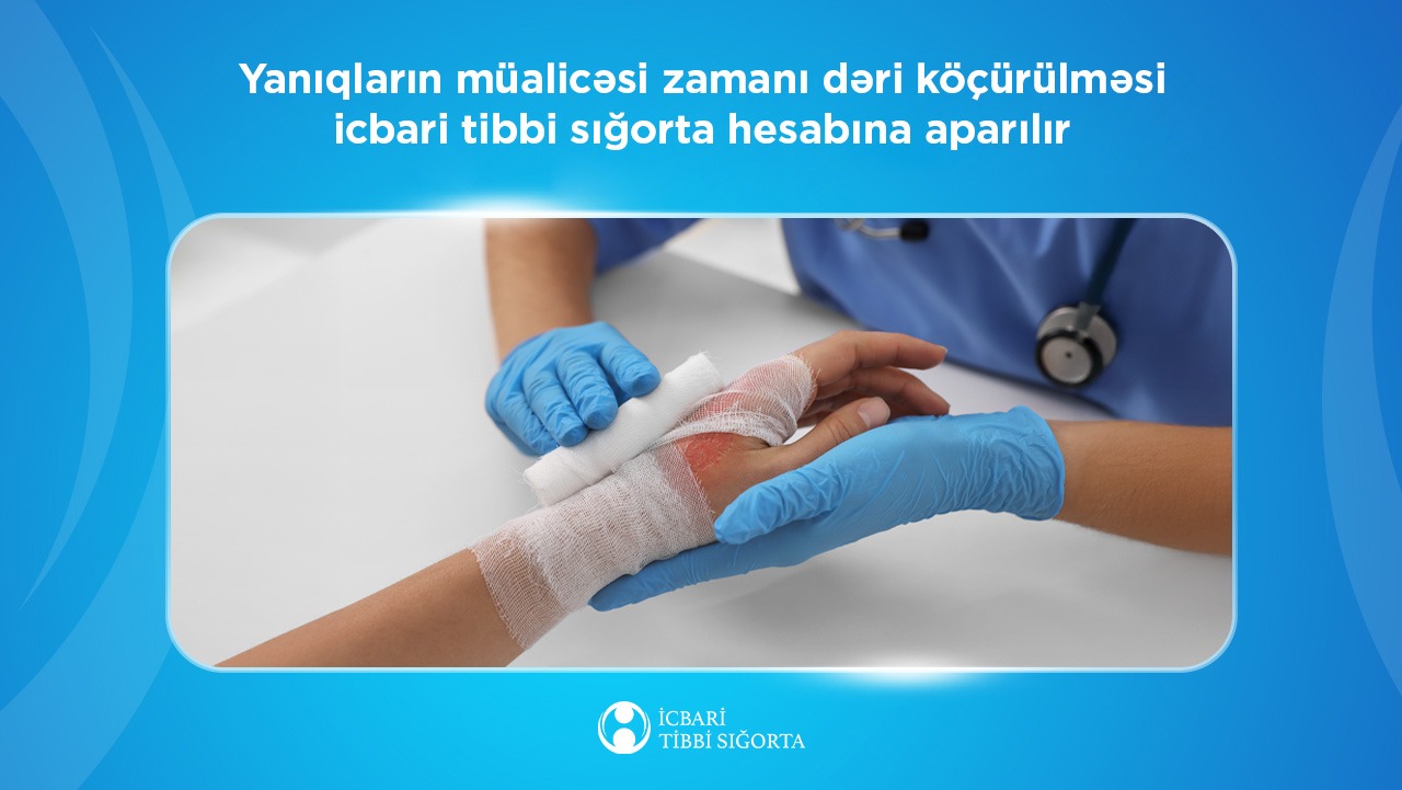 Yanıqların müalicəsi icbari tibbi sığorta hesabına həyata keçirilir