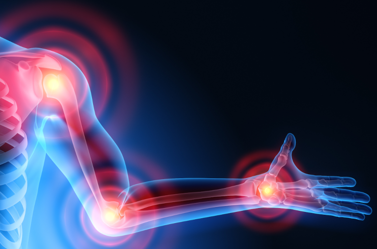 Yağışlı havalarda revmatizm xəstələri nələrə diqqət etməlidir?