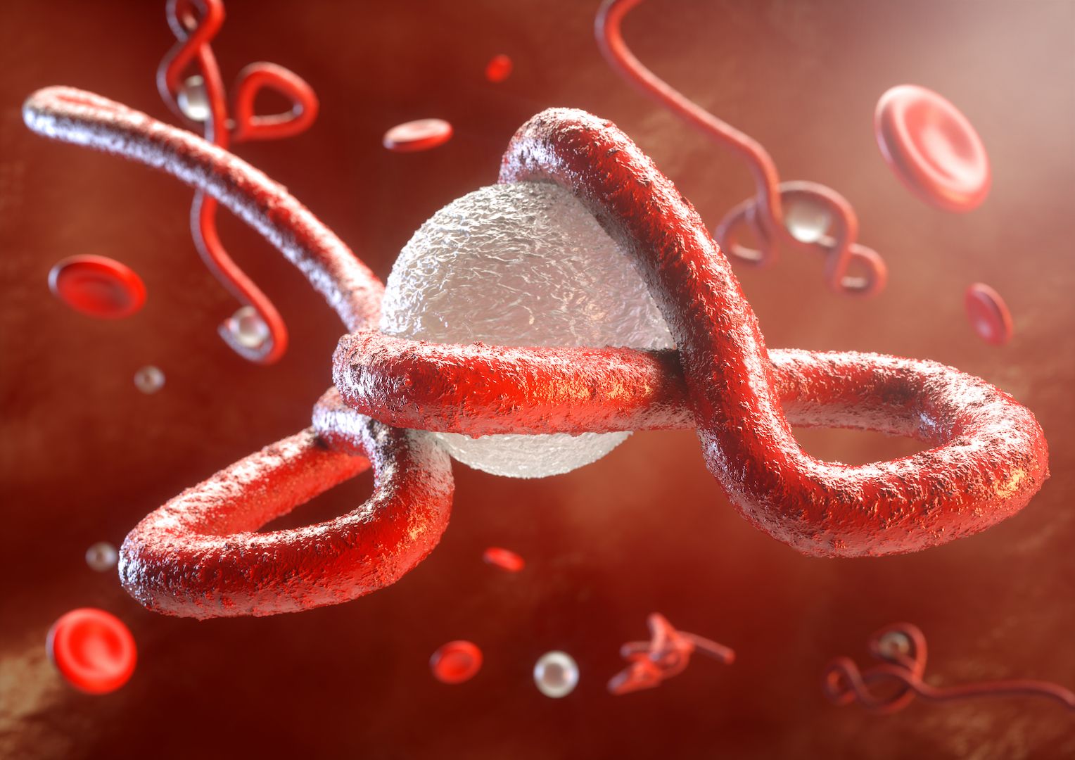 ÜST: "Ebola" qızdırmasından 139 nəfər ölüb